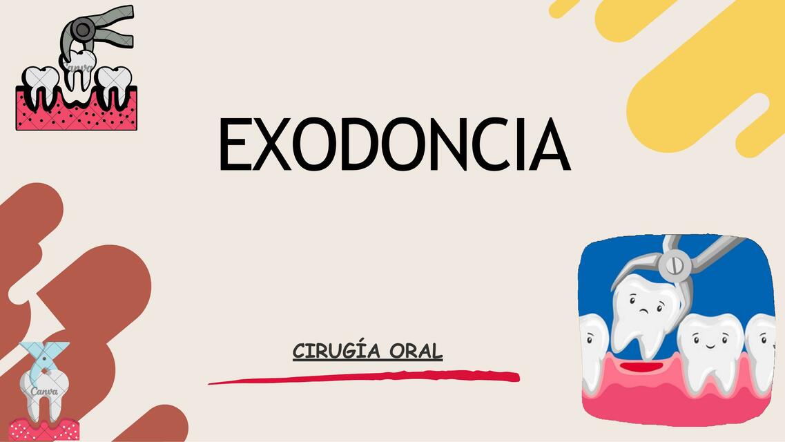 Exodoncia Dental