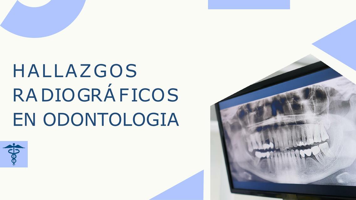 Hallazgos Radiográficos en Odontología 