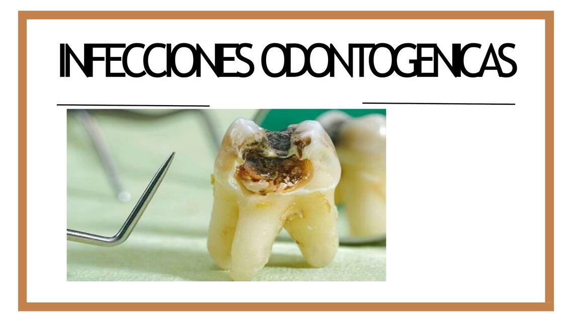 Infecciones Odontogénicas 