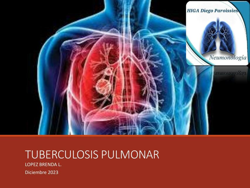 Tuberculosis Pulmonar 