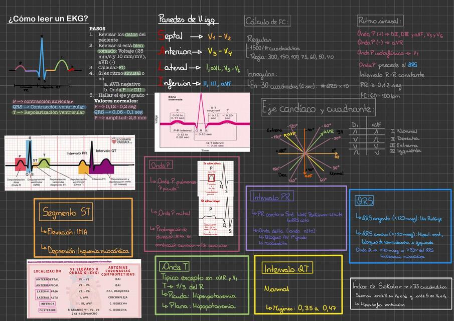 Cómo Leer EKG