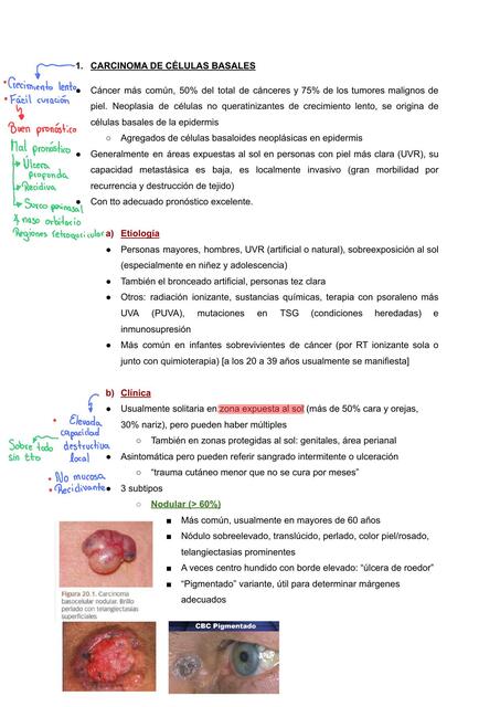 Carcinoma de células basales   