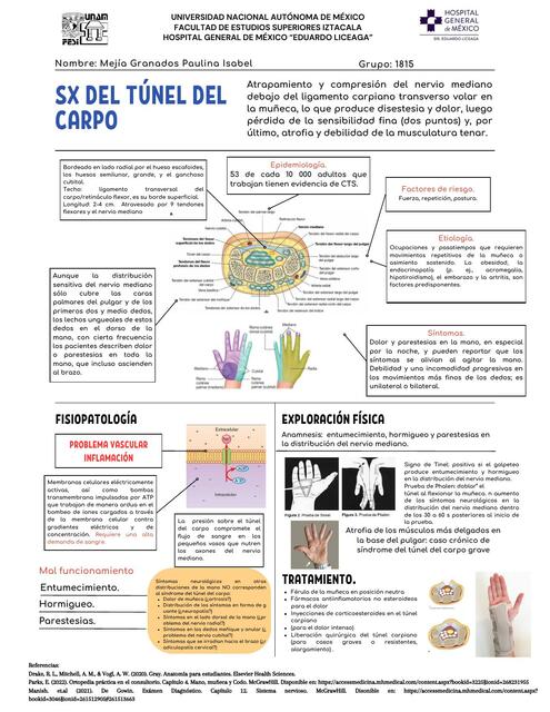 Síndrome del Túnel del Carpo