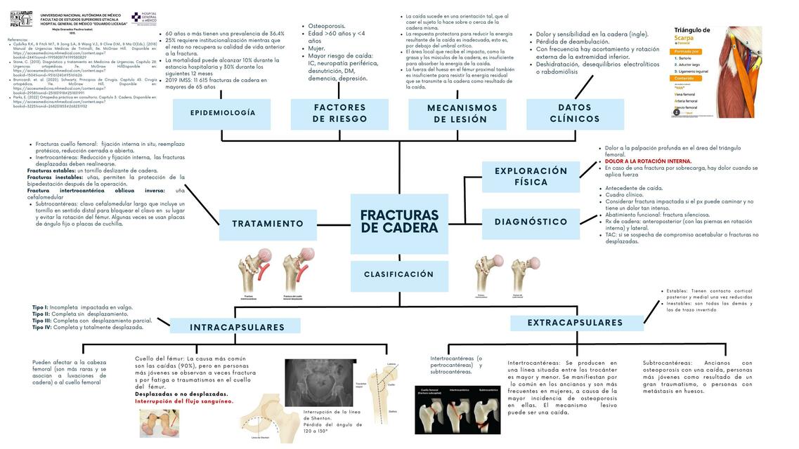 Fracturas de Cadera