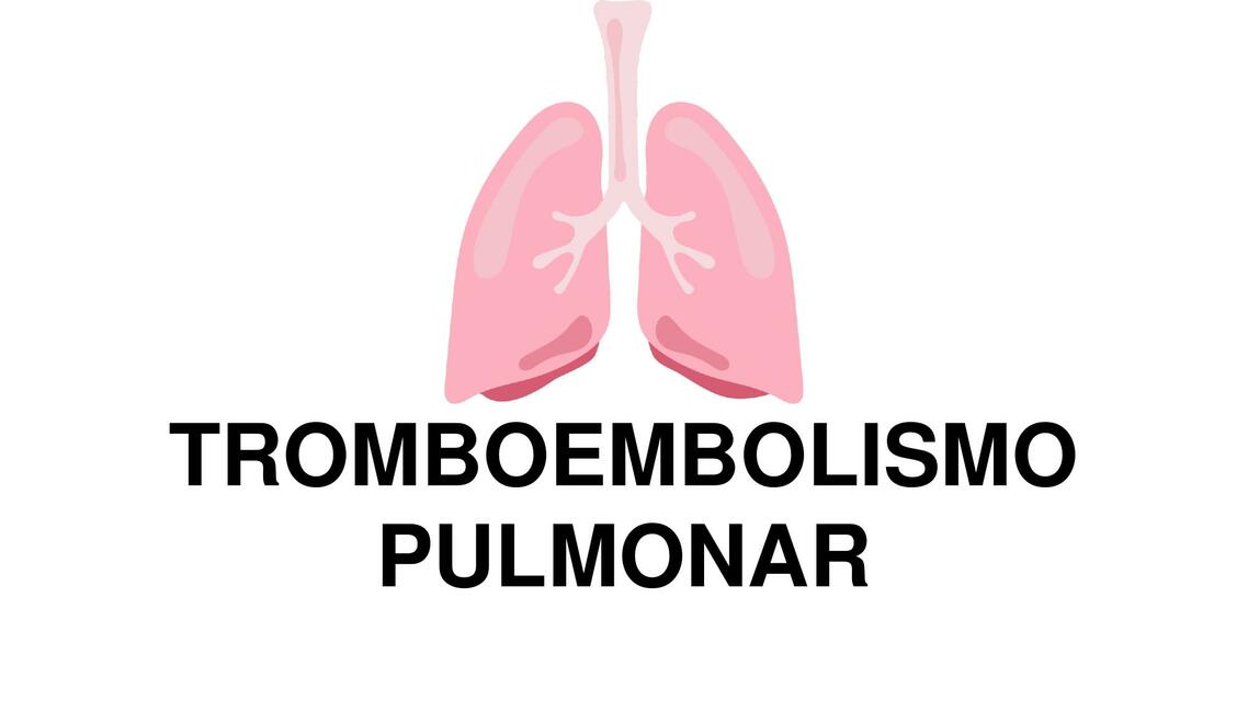 Tromboembolismo pulmonar