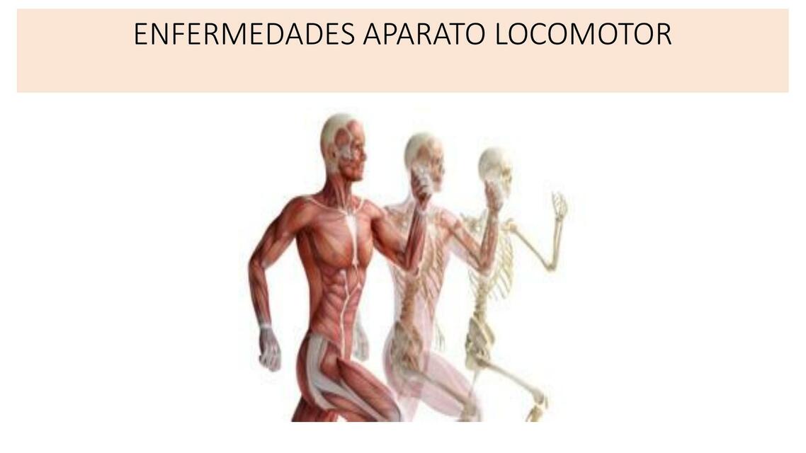 Enfermedades aparato locomotor