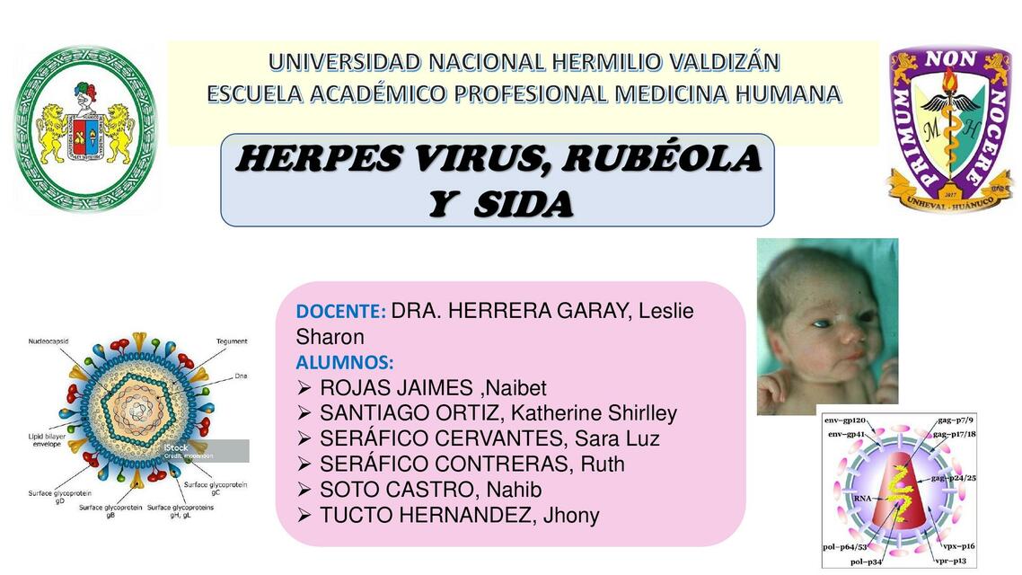 Herpes virus, rubéola y sida 