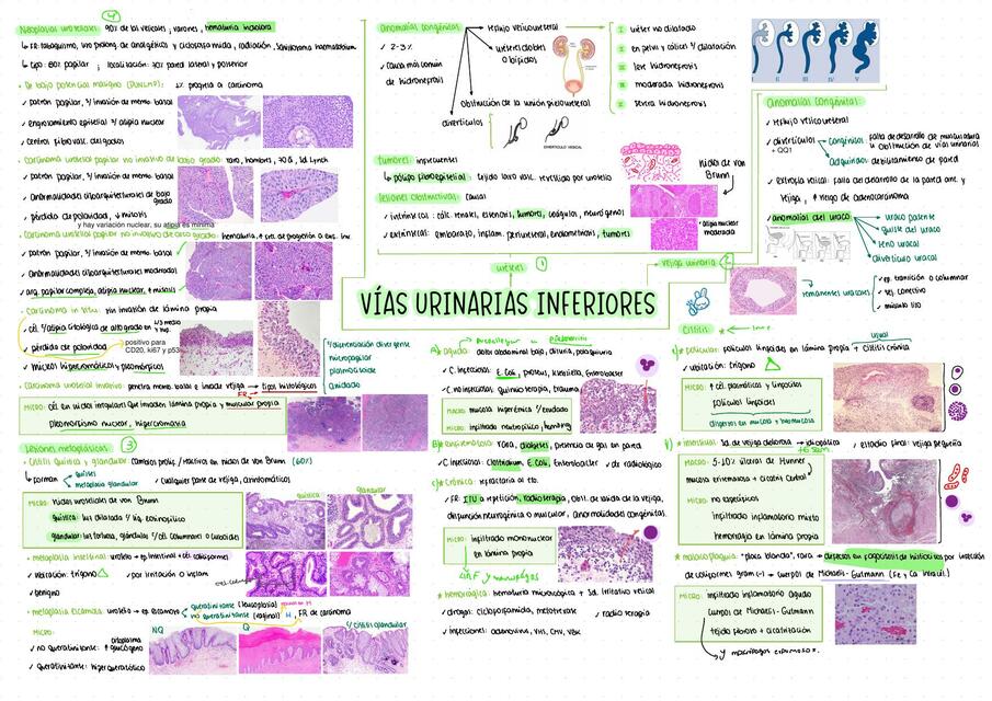 Vías Urinarias Inferiores 