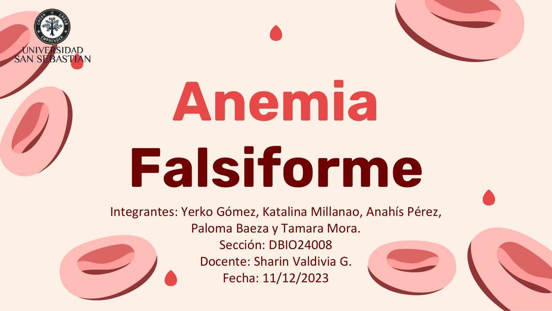 Anemia falciforme