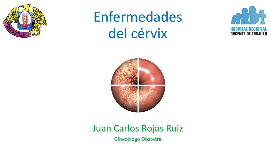 Enfermedades del Cérvix