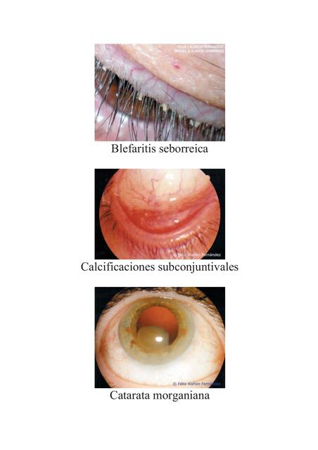 Atlas enfermedades oculares 