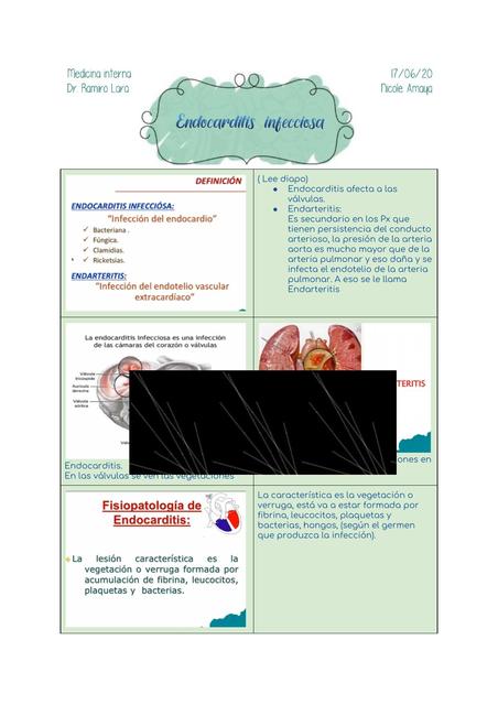 Endocarditis infecciosa descripción 