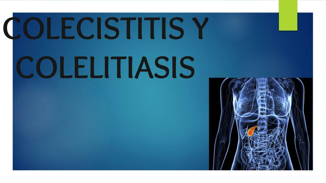 Colecistitis y colelitiasis