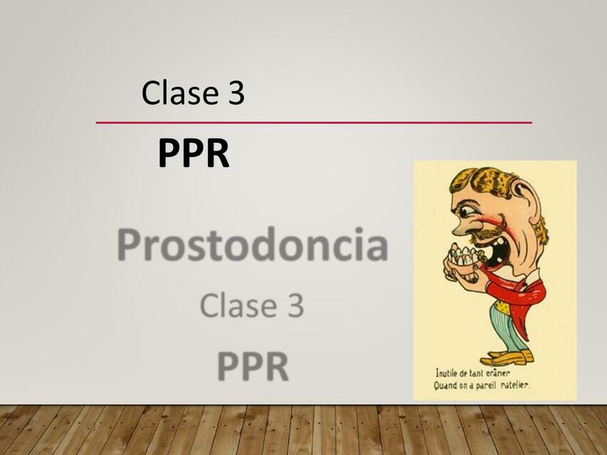 Prostodoncia prótesis parcial removible 