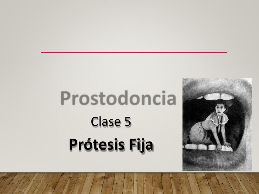 Prostodoncia prótesis fija 