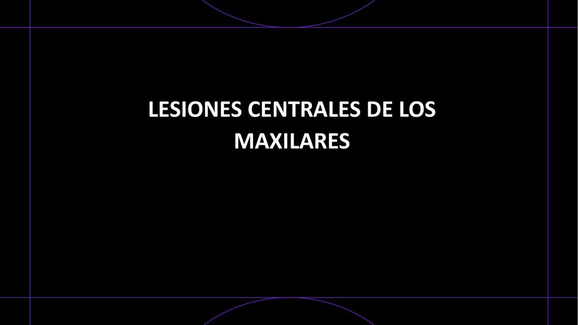 Lesiones centrales de los maxilares 