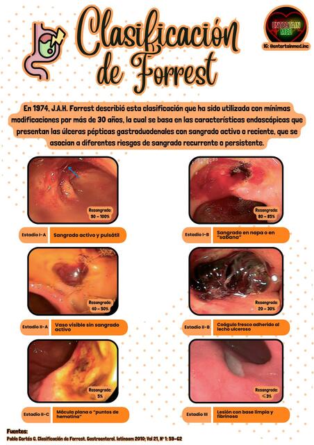 Clasificación de Forrest | EntertainMed.Inc | uDocz