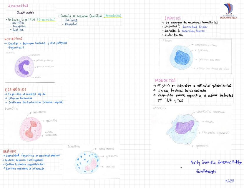 Leucemia KGZH