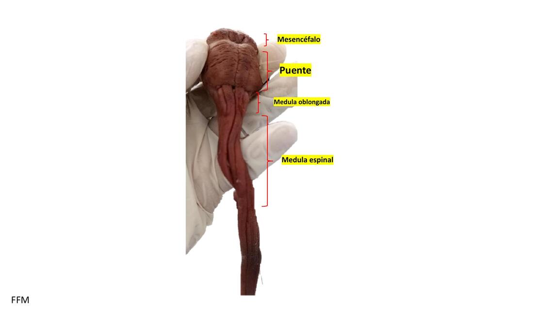 Neuroanatomía práctica   