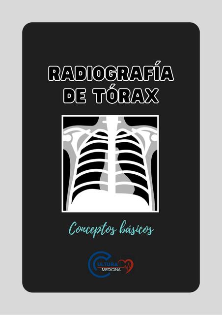 Radiografía de tórax 