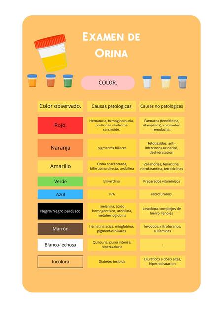 Examen de Orina