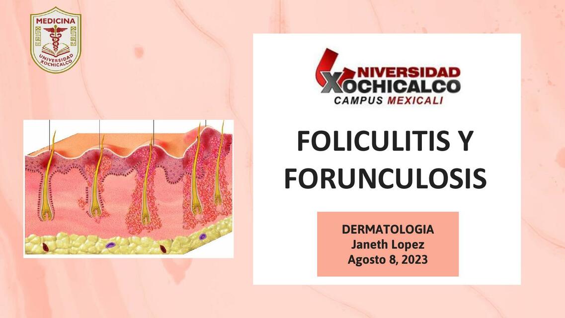 Foliculitis y forunculosis