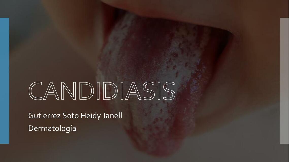 Candidiasis