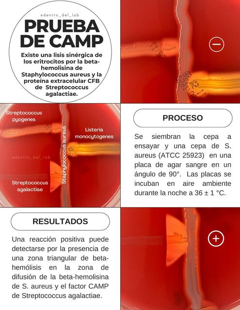 Prueba de CAMP