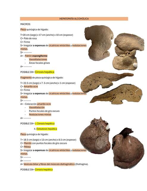 HEPATOPATÍA