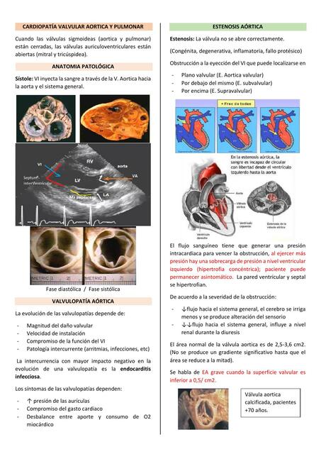 Cardiopatía valvular aortica y pulmonar