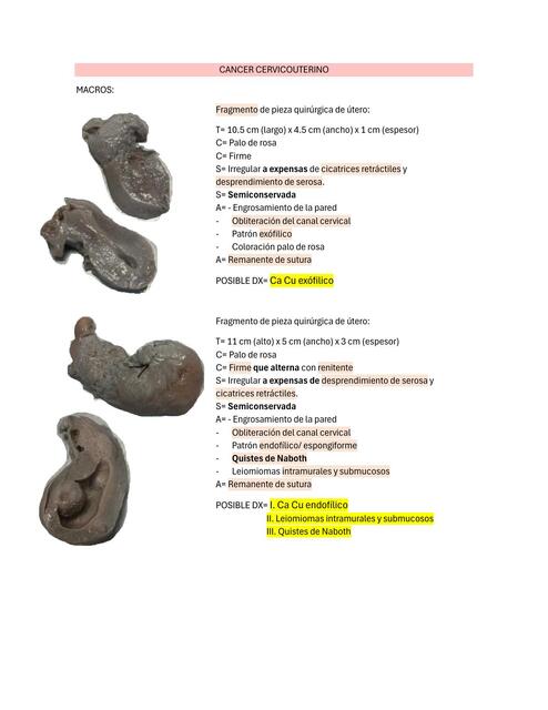 CANCER CERVICOUTERINO