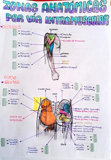 Zonas anatómicas por vía intramuscular 