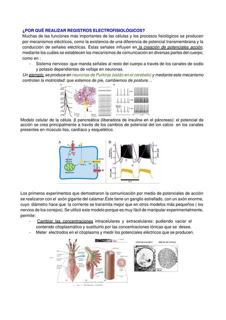 ¿Por Qué Realizar Registros Electrofisiológicos?