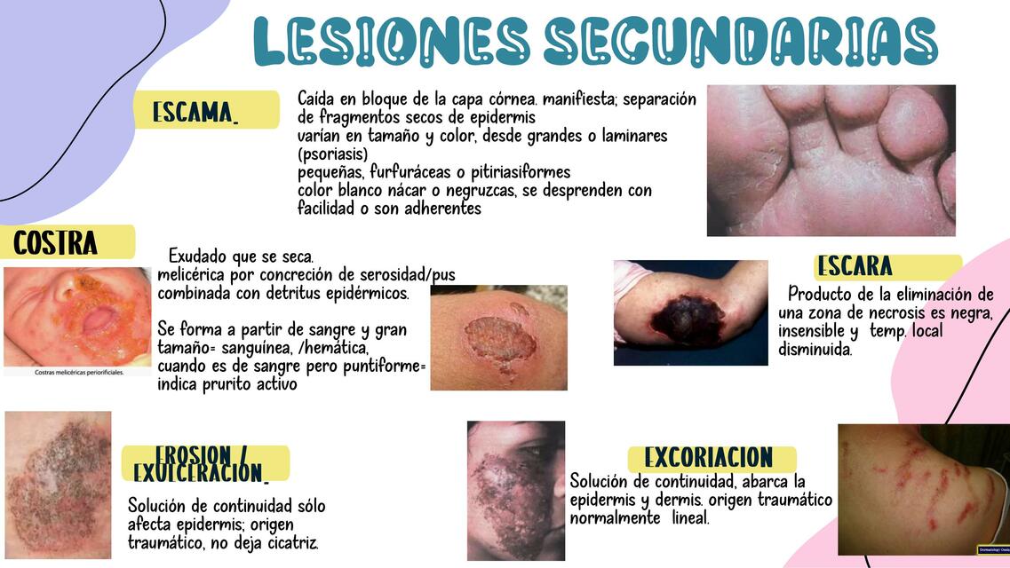 Lesiones Secundarios 