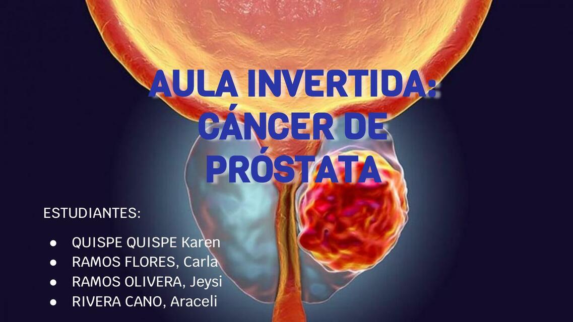 Cáncer de Próstata 