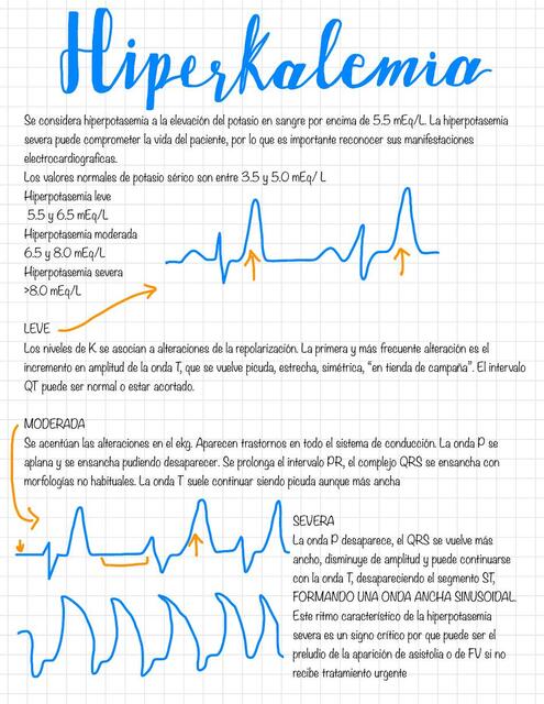 Hiperkalemia