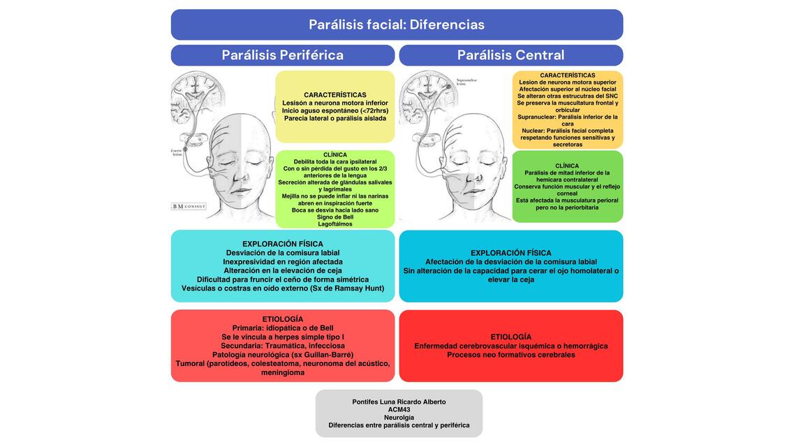 Diferencias parálisis central y periférica