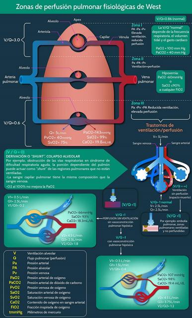 Infografia Ventilacion/Perfusion Zonas de West