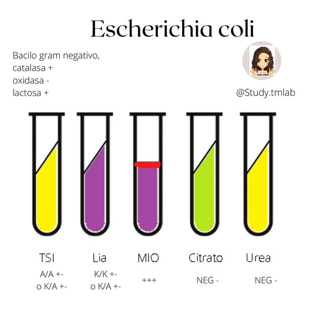 Escherichia Coli 