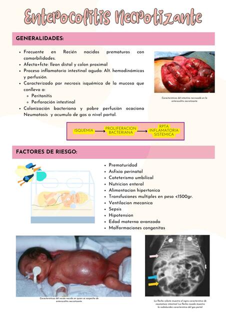 Enterocolitis Necrotizante