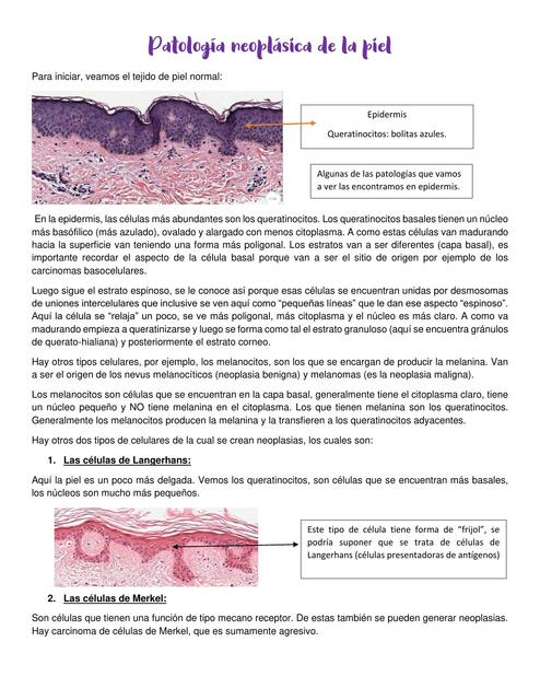 Patología Neoplásica de la Piel 