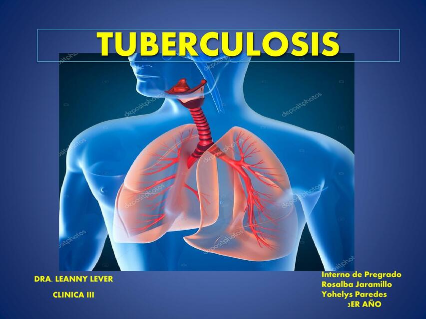 Tuberculosis