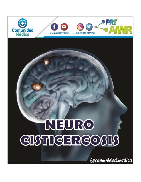 Neurocisticercosis - resumen