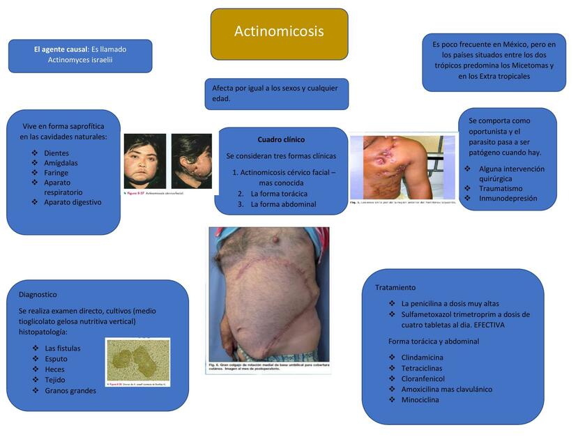 Mapas mentales dermatología 