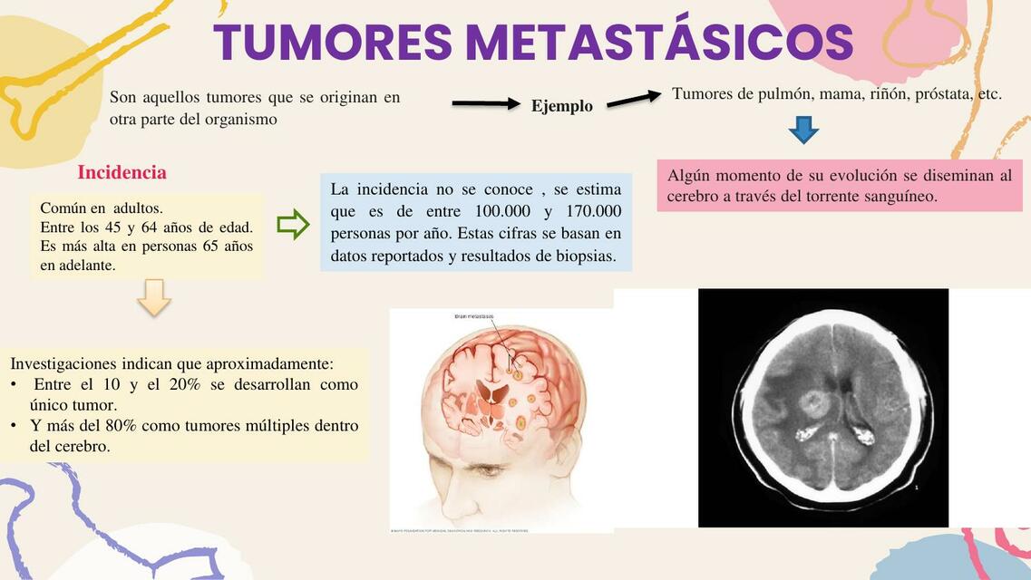 Snc Rmc Tumores del SNC | Doctor_teco | uDocz