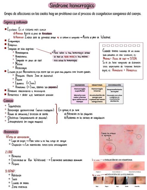Síndrome hemorrágico 