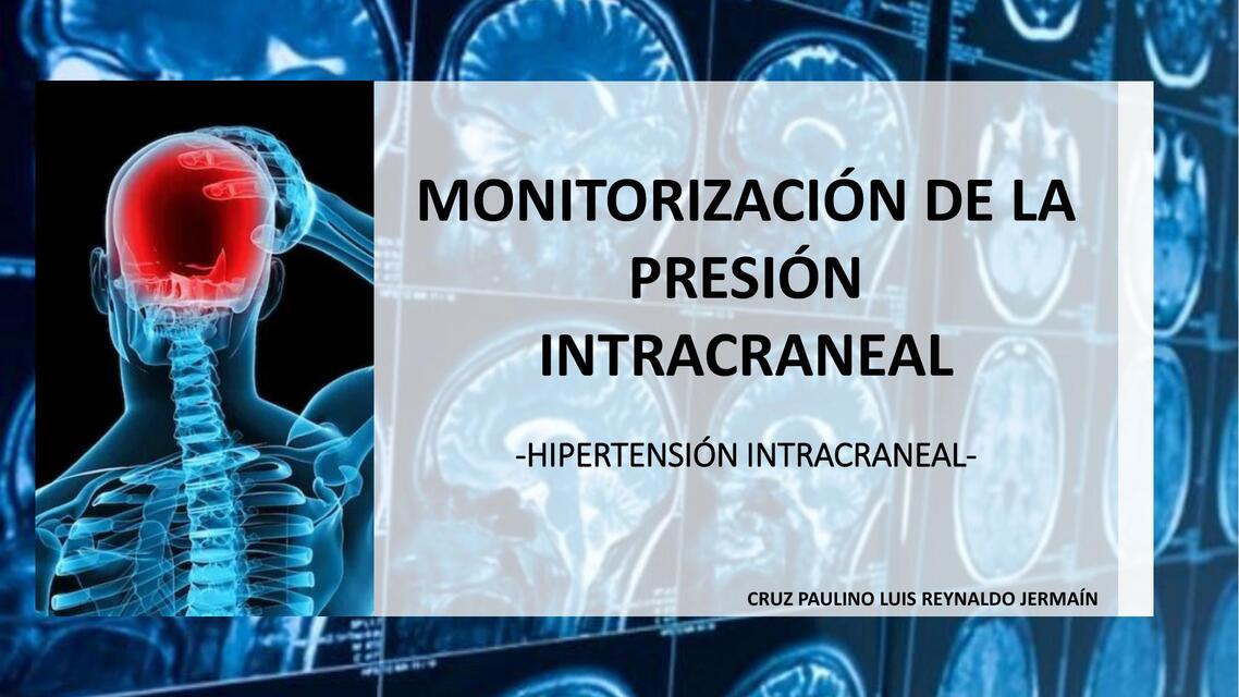 Monitorización de la presión intracraneal 