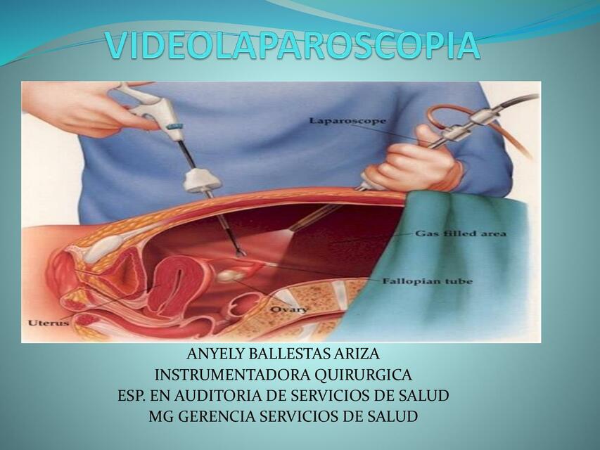 Videolaparoscopia 