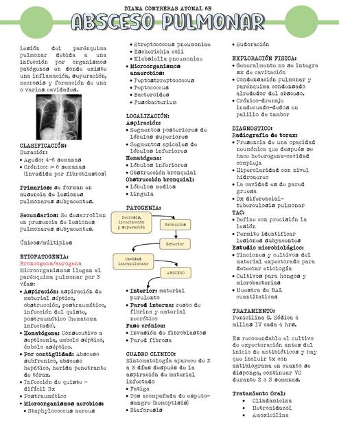 Absceso pulmonar 