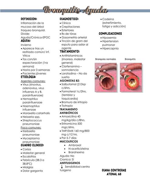 Bronquitis Aguda